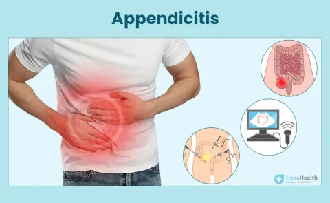 Appendicitis: Symptoms, Causes, and Treatment