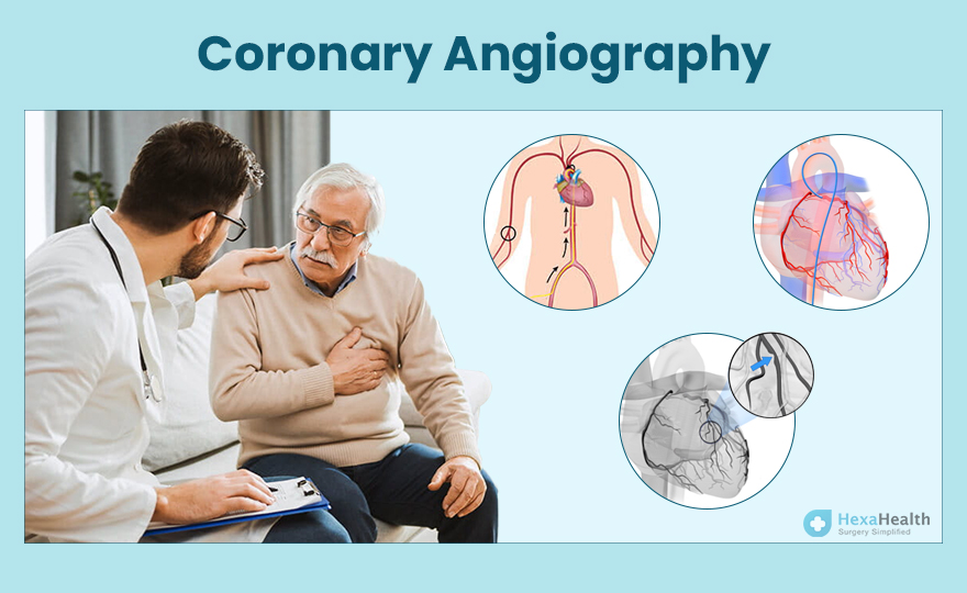Angioplasty: Symptoms, Causes, and Treatment