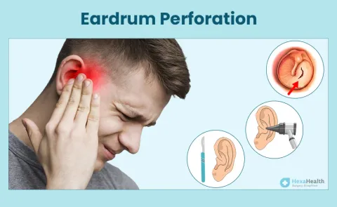 Ear Infection / Perforated Eardrum: Symptoms, Causes, and Treatment