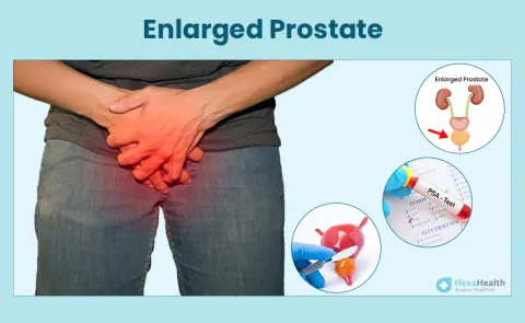 Enlarged Prostate: Symptoms, Causes, and Treatment