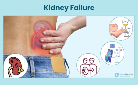 Kidney Failure: Symptoms, Causes, and Treatment