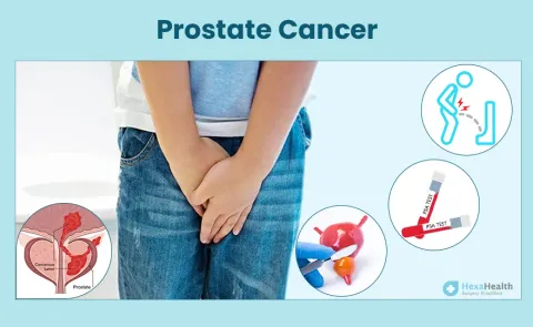 Prostate Cancer: Symptoms, Causes, and Treatment