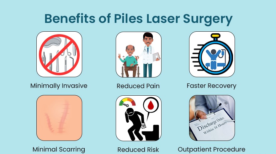 Benefits of Piles Laser Surgery