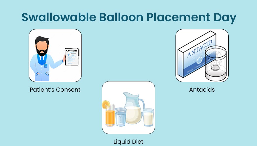 Swallowable Balloon Placement Day